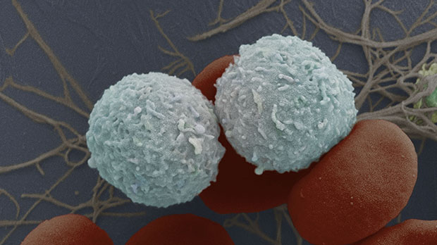 news.cancerresearchuk.org